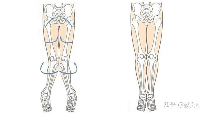 如果在膝蓋併攏後無法併攏小腿和腳踝,那麼就是骨盆前傾,股骨和膝蓋內
