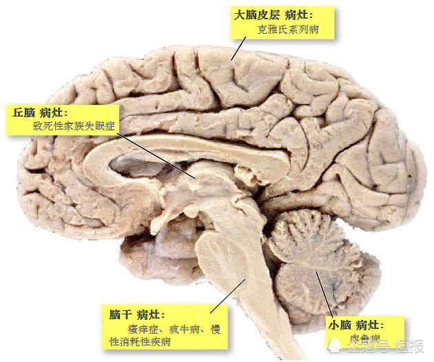 生物界|生物界毒王，感染后只能等死，冲击中心法则的朊病毒究竟是何方神圣？