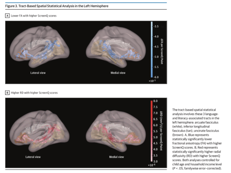 孩子|玩手机对孩子危害有多大？查阅无数论文后，我震惊了……