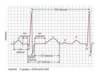 臨床執業醫師實踐技能《心電圖》速記口訣!
