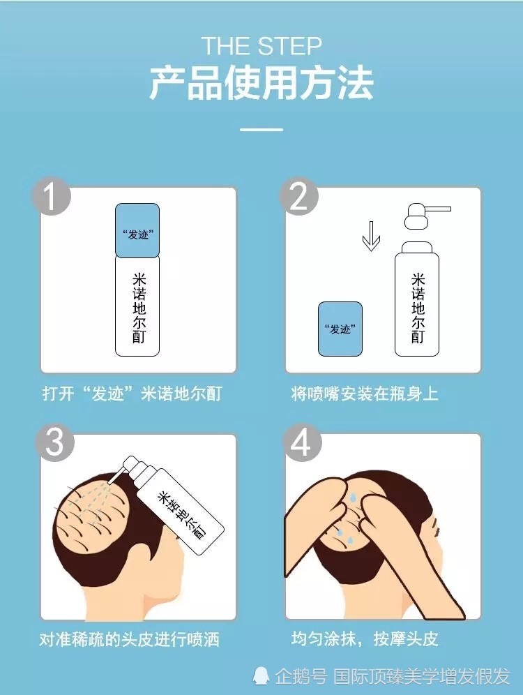 1,按照规定用法用量使用 其实关于用法用量,米诺地尔的说明书里有明确