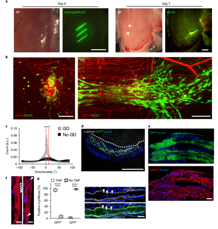 脑膜瘤|脑科学日报：超声有望治疗最致命的脑瘤；焦虑为何会让你发胖？