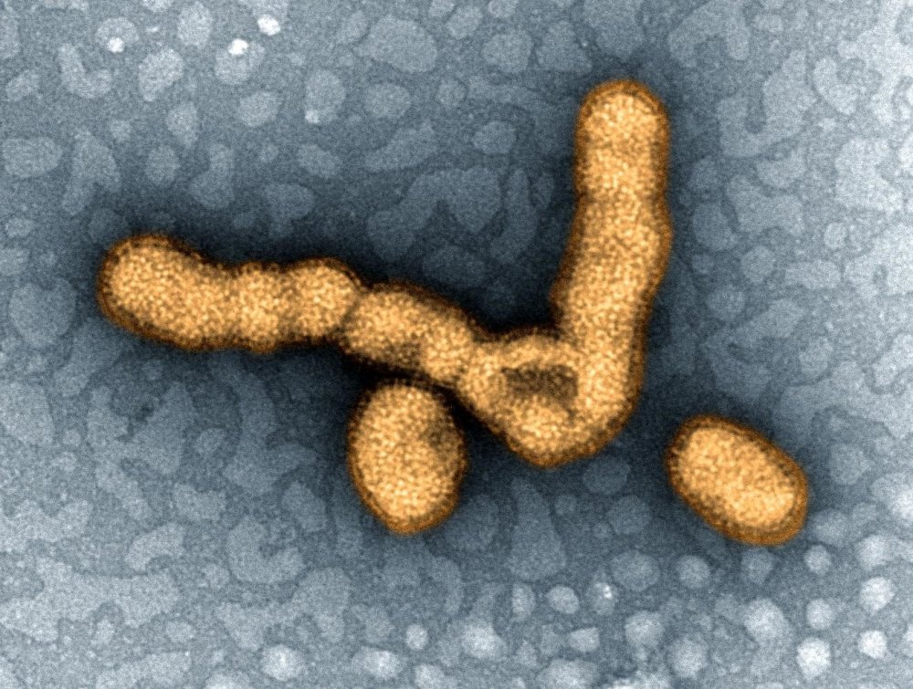 新型h1n1豬流感病毒被發現美科學家是這樣解釋的