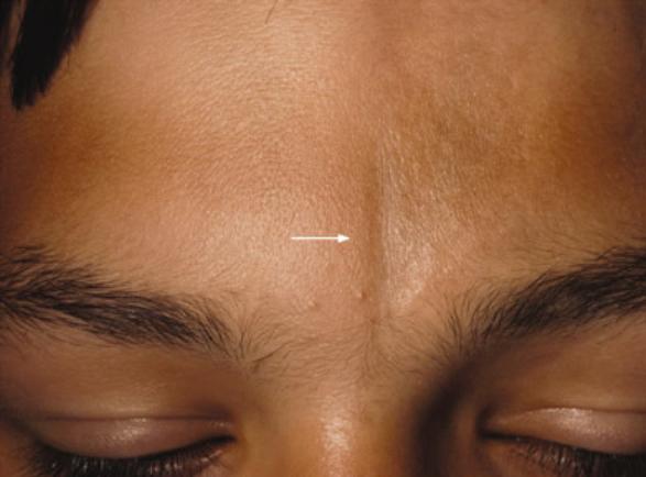 【杏林微科普】如何让生活远离硬皮病的困扰