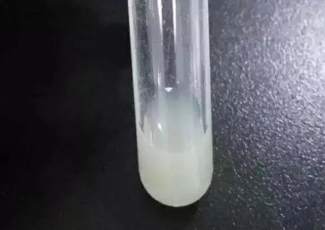 1,乳白色正常情况下,尿液是清澈的淡黄色,只有氨味无异味,而一旦出现