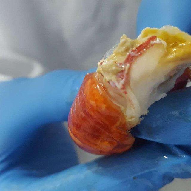 4种含寄生虫最多的美食小龙虾上榜家长别再给孩子吃了