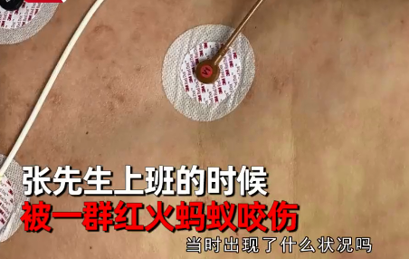 一名男子在上班的时候被一群红火蚂蚁咬伤,随后就出现了高烧40度以上