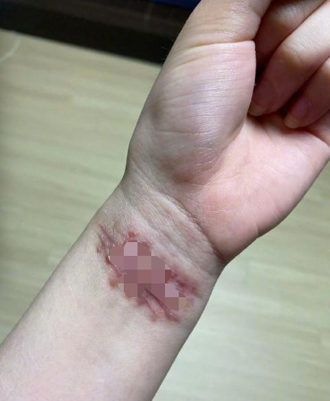 韩前女团成员自曝遭队友霸凌受欺负长达10年晒割腕照触目惊心