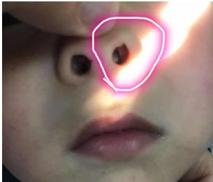 儿童鼻子内部图片图片