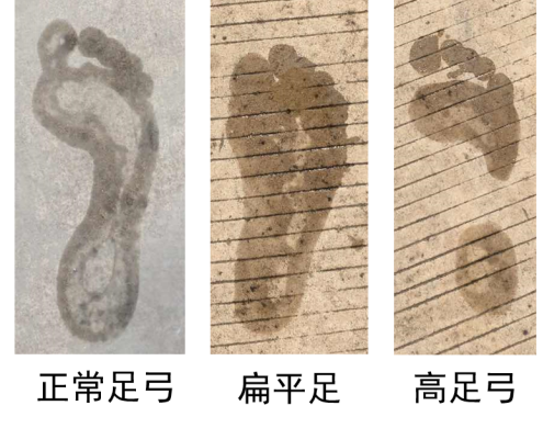 上踩上脚印,这是就可以通过足底轮廓大体分辨出自己是属于正常足弓,亦
