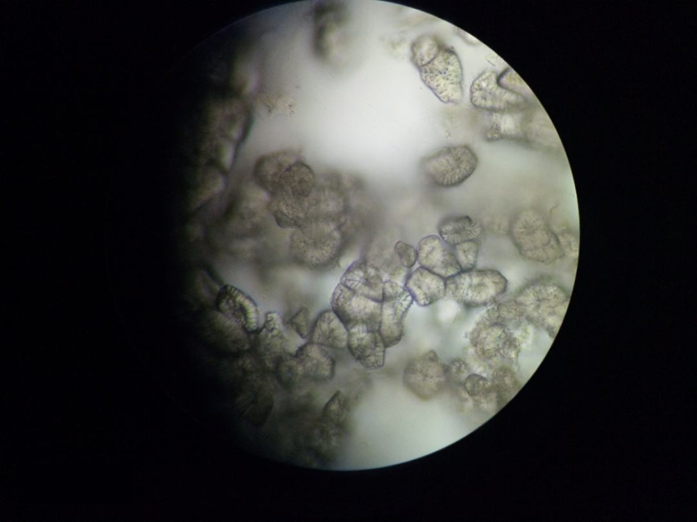 梨子石细胞图片