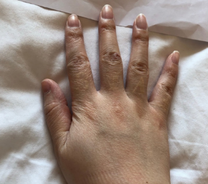 中国好声音|她从《中国好声音》退赛后遭遇封杀，如今活成最美的样子