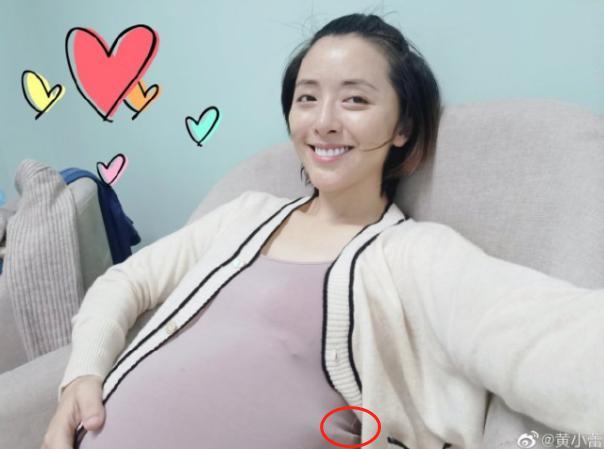 黄小蕾|“傻姑”黄小蕾肚大如箩，疑似官宣二胎？39岁素面朝天，发量堪忧