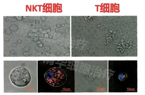 nktnkt细胞谁才是肿瘤细胞的超级杀手
