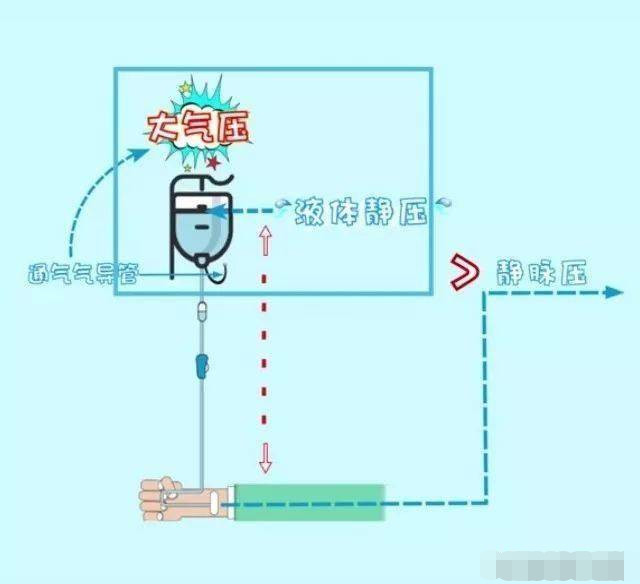 打吊针睡着了吊针瓶没有液了也不知道对身体有什么影响看完不淡定了