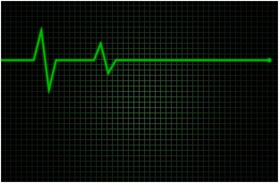 aed,心跳骤停患者的"救命神器"!