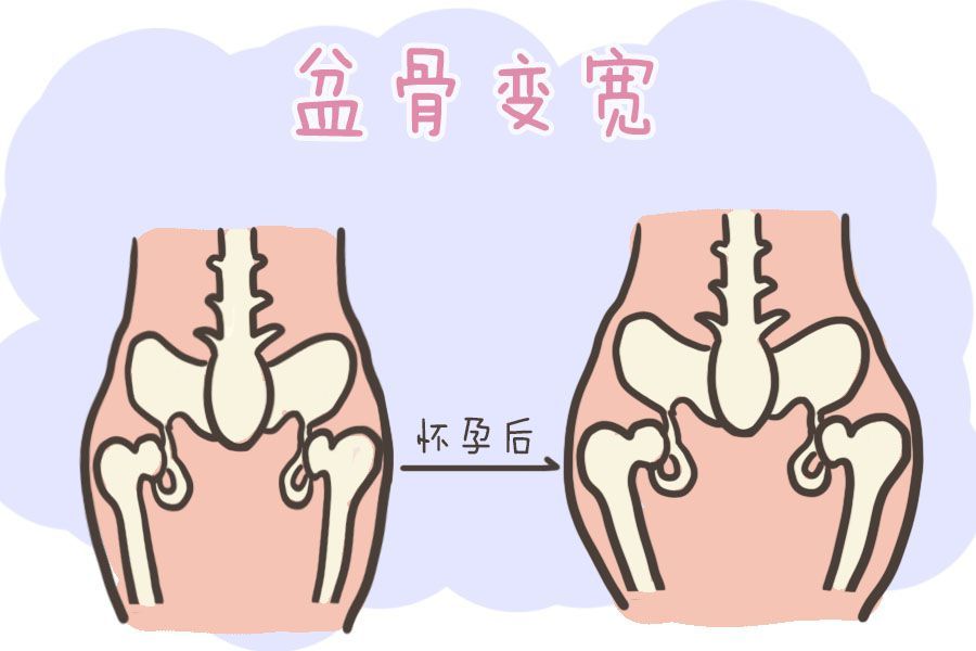 生孩子前后骨盆对比照图片