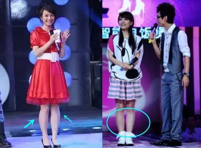 吴昕小腿为啥突然变细看到她睡前的一个举动太拼了