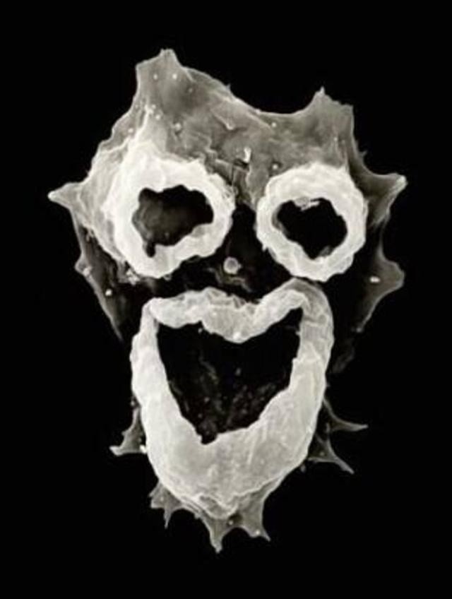 又见食脑变形虫可致人死亡美国佛罗里达州确诊1例