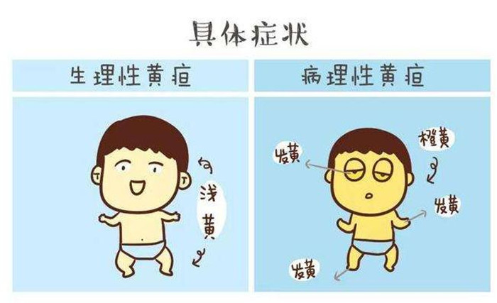 新生儿黄疸知多少