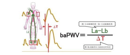 篩查血管狹窄和判斷血管功能利器同步四肢血壓和臂踝脈搏波速度測量