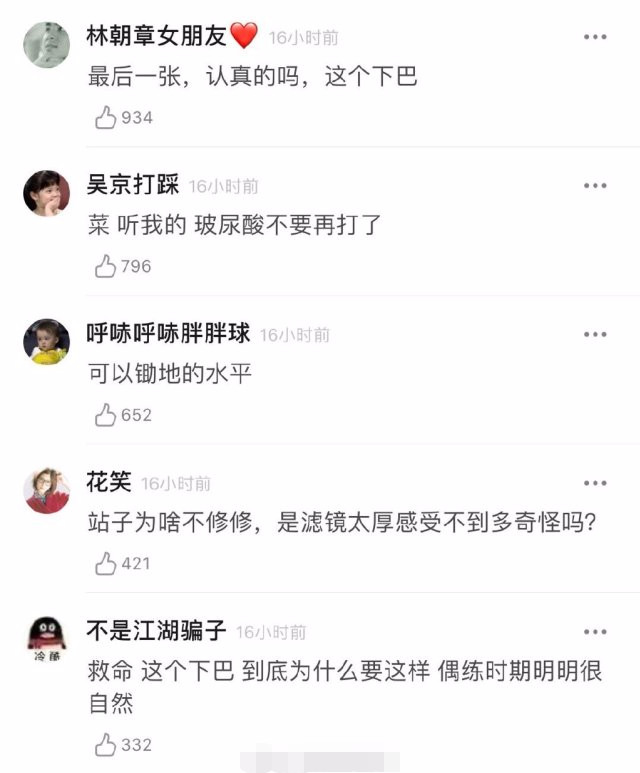 蔡徐坤|蔡徐坤再被质疑整容，侧面照下巴太尖形状奇怪，被吐槽可以锄地了