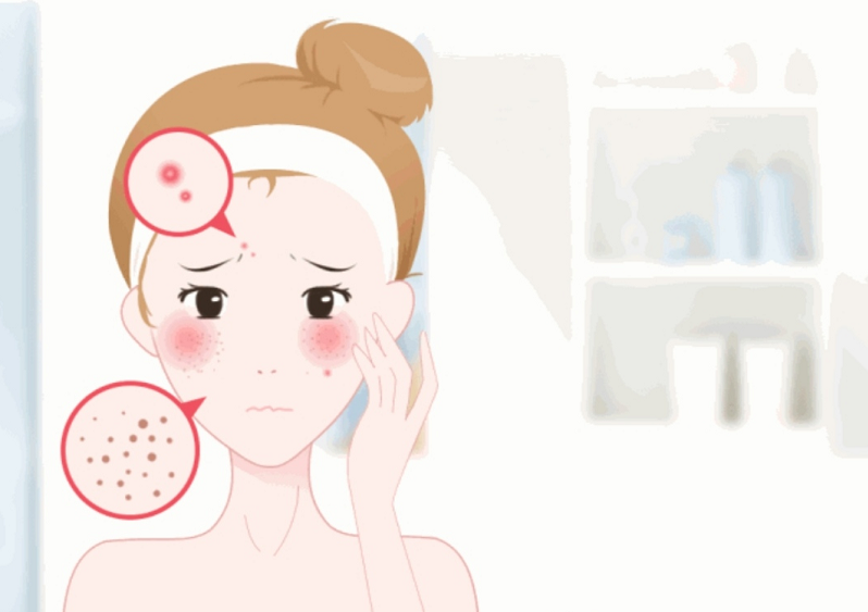 为什么夏季皮肤出油多?mecmor名膜壹号教你如何应对