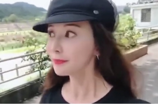 林志玲|林志玲近况不听声音认不出，脸部网红味十足，昔日女神变化太大