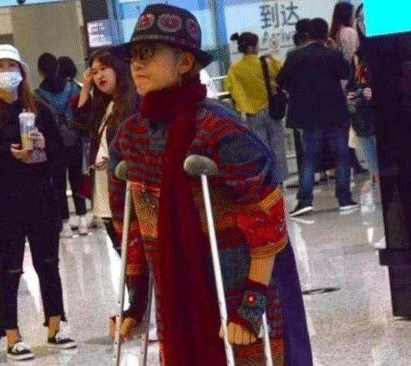 杨丽萍|60岁杨丽萍仙气全无，剪掉了长指甲，小腿摔伤骨折拄拐杖出行