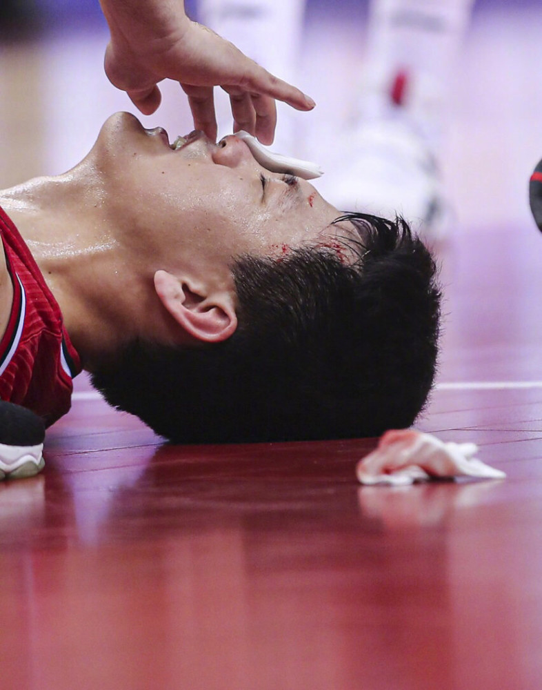 新疆男篮赢球输人品,前cba状元血洒赛场,眼角3厘米伤口缝10针