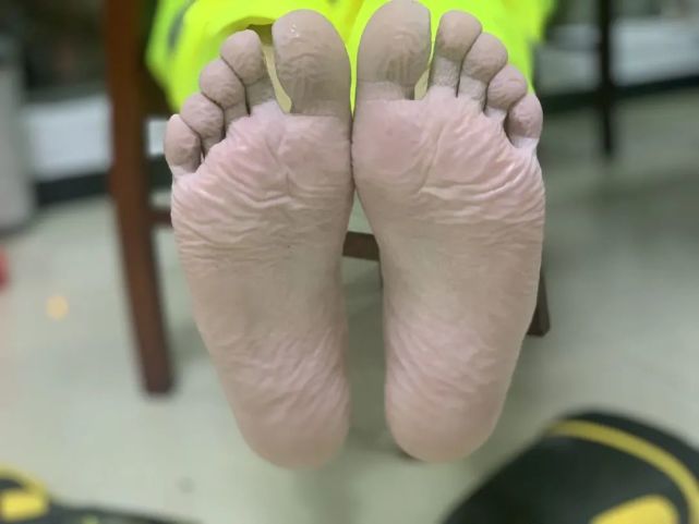 昨夜今晨,一组消防员执行救援任务返回时脱下战斗靴的赤脚照和微信
