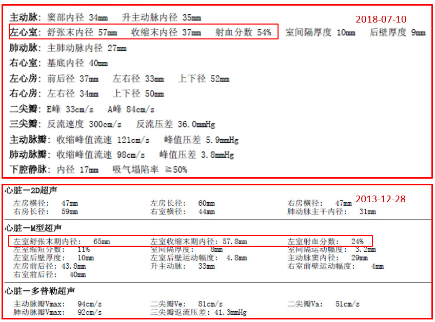 详解心脏彩超报告中的射血分数