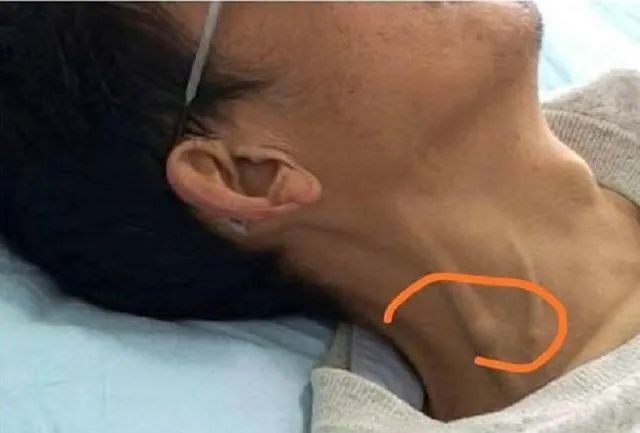 大多数人对这个数字可能无感,咱们打个直观点的比方:如果脖子一直被