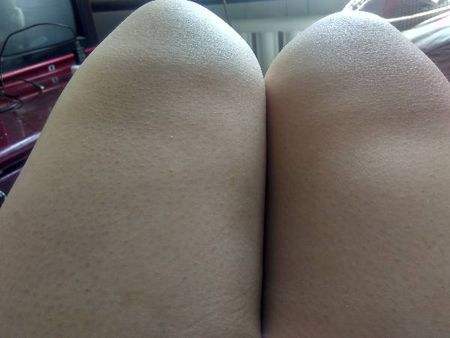 上岁数腿疼怎么回事?医生:伤害膝盖的5件事,你可能每天都在做