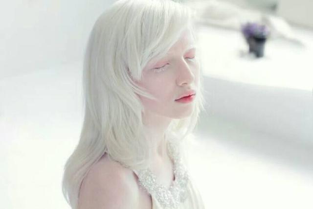 非洲最珍贵人种险些被当地人灭绝血液比黄金还昂贵