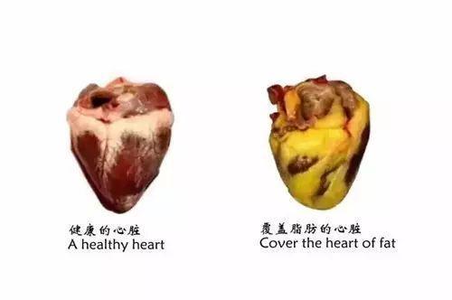 内脏脂肪是健康杀手,4个良心建议,帮你有效降低内脏脂肪