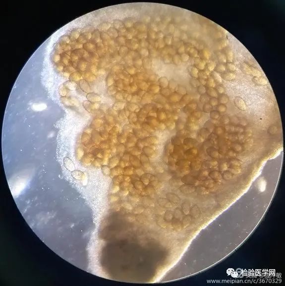 小且圆,其体往身后逐渐变宽,类似倒三角形,体内充满了团块聚集的虫卵