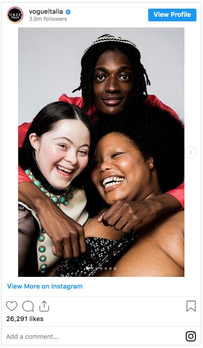 太美了唐氏综合症少女成奢侈品大牌模特彩妆广告瞬间走红