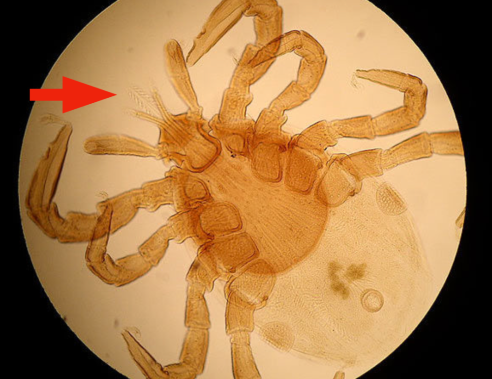 3.蜱虫的口器是由两对鳌足和中间的垂唇构成.