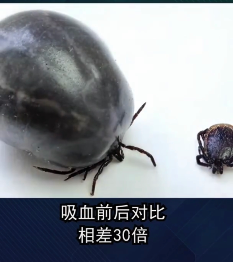 虫子爬到肉里去了,快!帮我拔出来!