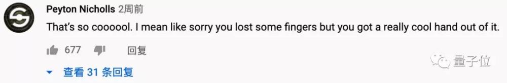 爱德华·艾尔利克|这只机械手太硬核！失去手指的机械工程师独立打造，网友：太酷了