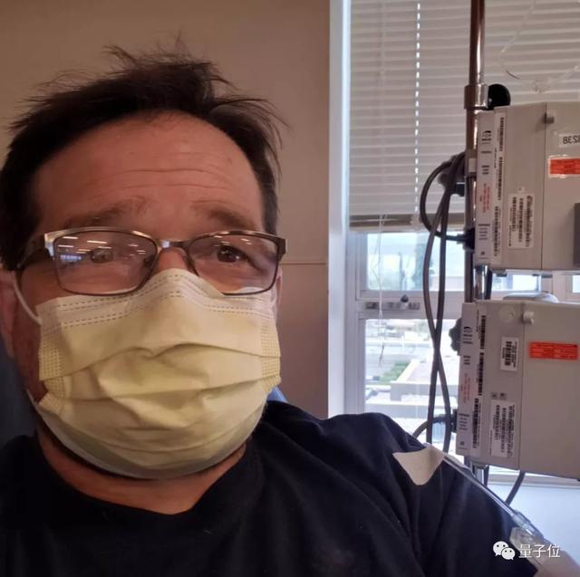 爱德华·艾尔利克|这只机械手太硬核！失去手指的机械工程师独立打造，网友：太酷了