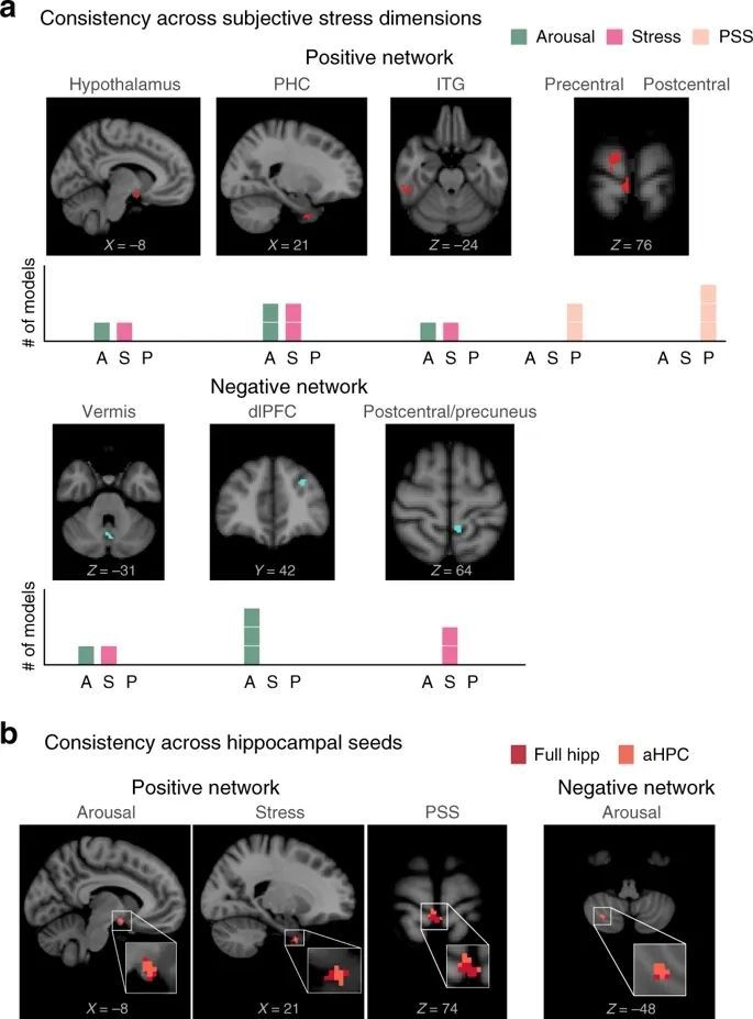 大脑网络|耶鲁大学发现了造成压力的大脑网络！未来可通过调节脑信号缓解压力