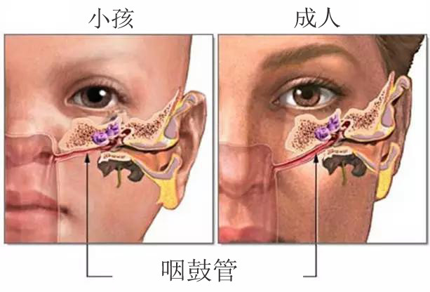 耳膜穿孔怎么办 一定要手术吗