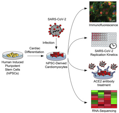 细胞|Cell子刊：新冠病毒可感染心脏细胞！