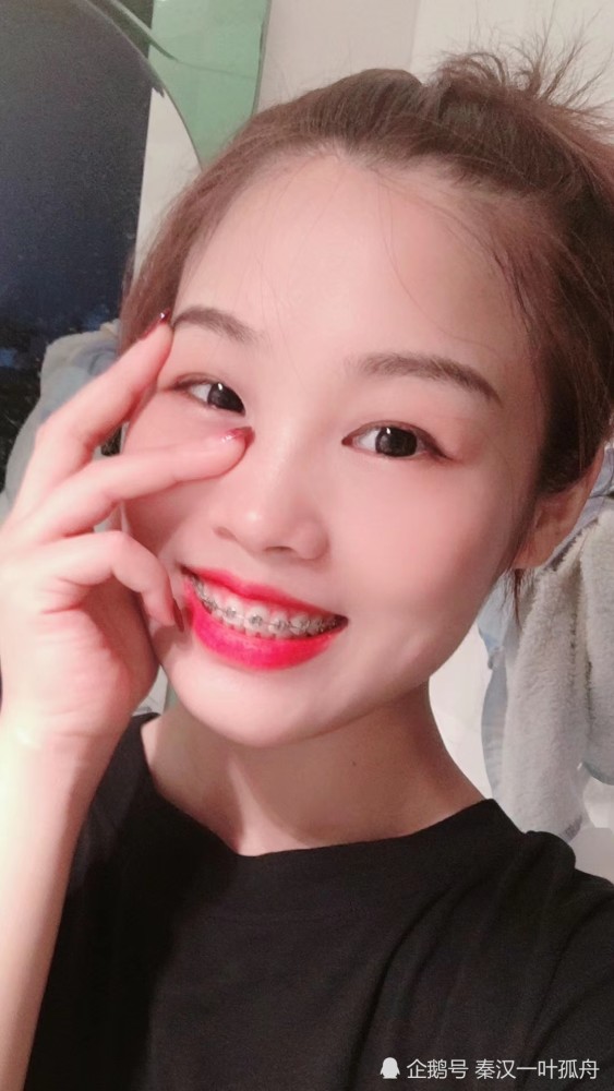 我是牙套女孩,美丽与自信