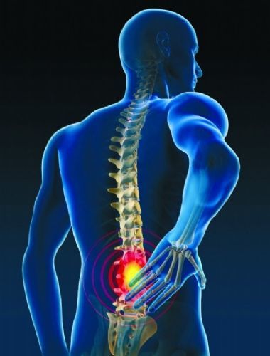 强直性脊柱炎问题汇总