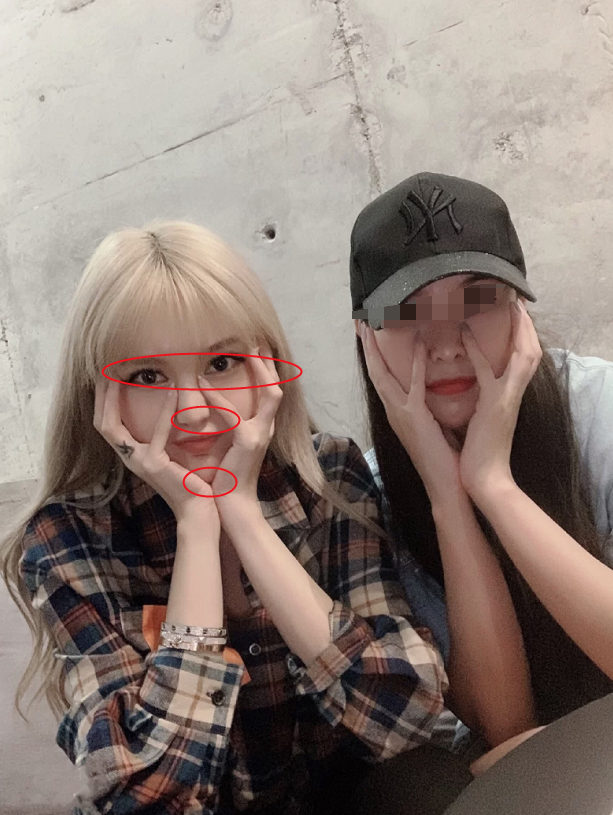 周扬青|网友偶遇周扬青与其合照，却暴露她整容后遗症，锥子脸极不自然