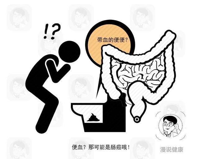 大肠癌|肠内有癌，放屁告知？若还出现这2个现象，暗示肠癌已到来？