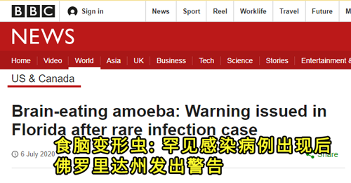 食脑虫|“食脑虫”再现美国，致死率高达97％，但这还不是最可怕的